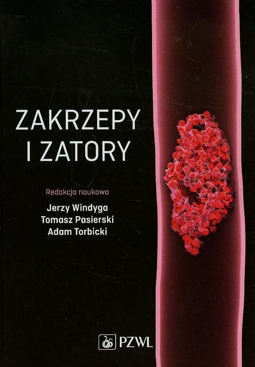 

Zakrzepy i zatory