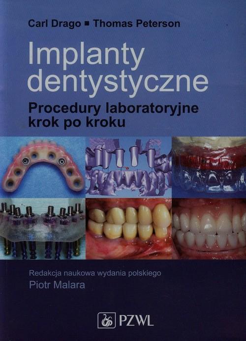 

Implanty dentystyczne Procedury laboratoryjne krok