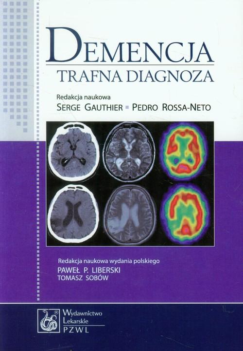 

Demencja Trafna Diagnoza