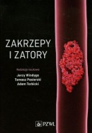 Zakrzepy i zatory Windyga Jerzy, Pasierski Tomasz, Torbicki Adam