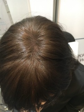 Na zagęszczenie włosów- mikrowłókna Hairmax