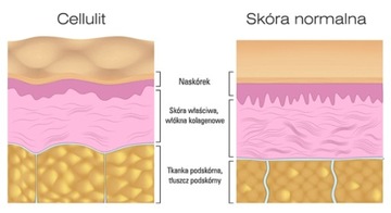 CELLULIT STOP KONCENTRAT KOFEINA CYNAMON BINGOSPA