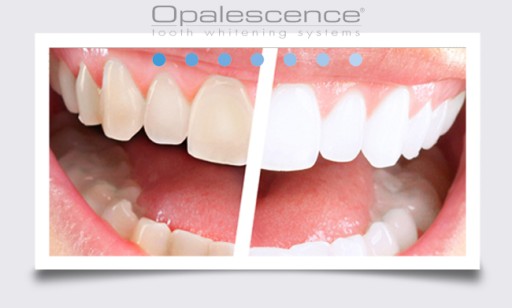 OPALESCENCE 4x% 16_3w1 ŻEL DO WYBIELANIA ZĘBÓW